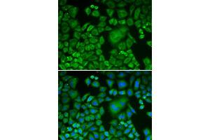 Immunofluorescence (IF) image for anti-ARP3 Actin-Related Protein 3 (ACTR3) (AA 1-418) antibody (ABIN3021339) (ACTR3 Antikörper  (AA 1-418))