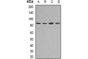 Western blot analysis of KAO expression in mouse liver (A), mouse heart (B), rat kidney (C), rat heart (D) whole cell lysates. (DAO Antikörper)