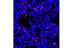 Immunofluorescence of paraffin embedded rat lung using Bora (ABIN7075236) at dilution of 1:200 (400x lens) (BORA Antikörper)