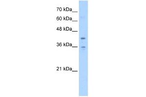 WB Suggested Anti-TMEM104 Antibody Titration:  5. (TMEM104 Antikörper  (Middle Region))