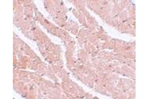 Immunohistochemistry of CAZIP in mouse heart tissue with CAZIP antibody at 5 μg/ml.