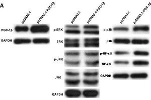 Peroxisome proliferator-activated receptor-gamma coactivator-1 β (PGC-1β) overexpression enhances proinflammatory cytokines, matrix metalloproteinases (MMPs) and receptor activator of nuclear factor-kappa B ligand (RANKL) production in rheumatoid arthritis (RA)-fibrolast-like synoviocytes (FLS). (PPARGC1B Antikörper  (AA 901-1023))