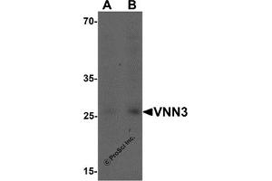 Western Blotting (WB) image for anti-Vanin 3 (VNN3) (C-Term) antibody (ABIN1077383) (VNN3 Antikörper  (C-Term))