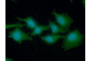 ICC/IF analysis of EEF1A1 in A549 cells line, stained with DAPI (Blue) for nucleus staining and monoclonal anti-human EEF1A1 antibody (1:100) with goat anti-mouse IgG-Alexa fluor 488 conjugate (Green). (eEF1A1 Antikörper)