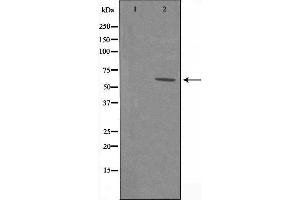 Western blot analysis of extracts from COLO205 cells, using HRH1 antibody.