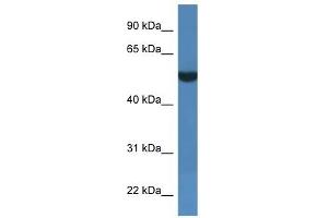 Western Blot showing FSD1L antibody used at a concentration of 1 ug/ml against THP-1 Cell Lysate (FSD1L Antikörper  (C-Term))