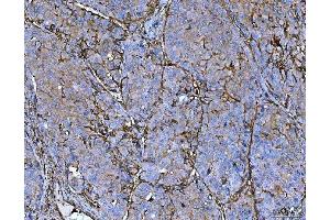 IHC analysis of P Glycoprotein/ABCB1 using anti-P Glycoprotein/ABCB1 antibody (ABIN7599525).