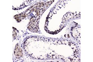 IHC analysis of SMC6L1 using anti-SMC6L1 antibody (ABIN5693133). (SMC6 Antikörper  (AA 205-443))