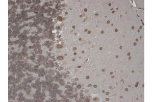IHC analysis of TrpM7 tested on mouse brain using a dilution of TRPM7 antibody.
