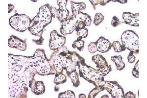 IHC analysis of HDAC5 using anti-HDAC5 antibody (ABIN6719321). (HDAC5 Antikörper  (AA 102-197))