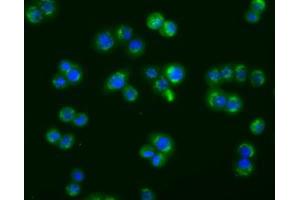 Image no. 7 for anti-Acetyl-CoA Acetyltransferase 2 (ACAT2) antibody (ABIN1496402) (ACAT2 Antikörper)