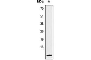 Western blot analysis of IL-8 expression in HeLa (A) whole cell lysates. (IL-8 Antikörper  (Center))