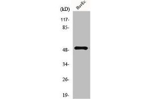 Western Blot analysis of HuvEc cells using Mnk1 Polyclonal Antibody (MKNK1 Antikörper  (Internal Region))