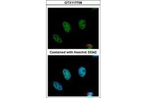 Image no. 1 for anti-Chromodomain Protein, Y-Like (CDYL) (AA 1-544) antibody (ABIN1497464) (CDYL Antikörper  (AA 1-544))