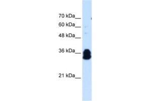 Western Blotting (WB) image for anti-Family with Sequence Similarity 134, Member B (FAM134B) antibody (ABIN2463987) (FAM134B Antikörper)