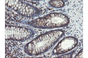 Image no. 2 for anti-Acyl-CoA Binding Domain Containing 3 (Acbd3) antibody (ABIN1498415) (ACBD3 Antikörper)