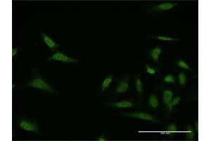 Immunofluorescence of monoclonal antibody to MKNK1 on HeLa cell. (MKNK1 Antikörper  (AA 1-100))