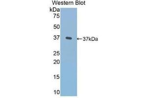 Western Blotting (WB) image for anti-Fibronectin (AA 313-607) antibody (ABIN1077665) (Fibronectin Antikörper  (AA 313-607))