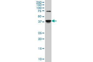 SGK2 monoclonal antibody (M04), clone 4B12 Western Blot analysis of SGK2 expression in PC-12 . (SGK2 Antikörper  (AA 293-367))
