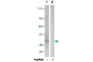 Western blot analysis of extracts from HepG2 cells, using IL2RB polyclonal antibody . (IL2 Receptor beta Antikörper)