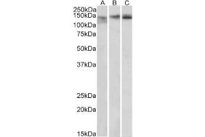 Western Blotting (WB) image for anti-Stromal Antigen 2 (STAG2) (Internal Region) antibody (ABIN571073)
