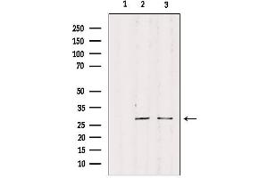 Western blot analysis of extracts from various samples, using RPS4Y1 Antibody. (RPS4Y1 Antikörper)