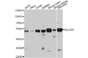 Western blot analysis of extracts of various cell lines, using SLC2A1 antibody. (GLUT1 Antikörper  (AA 210-310))