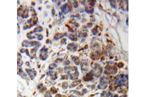 IHC-P analysis of Pancreas tissue, with DAB staining. (PIK3C2A Antikörper  (AA 349-611))