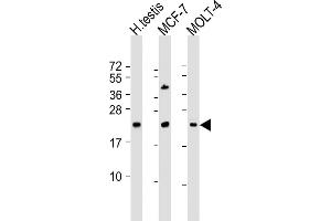 All lanes : Anti-STAG3L1 Antibody (Center) at 1:2000 dilution Lane 1: human testis lysate Lane 2: MCF-7 whole cell lysate Lane 3: MOLT-4 whole cell lysate Lysates/proteins at 20 μg per lane. (STAG3L1 Antikörper  (AA 108-136))