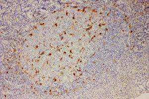 Anti-IL18 Picoband antibody,  IHC(P): Human Tonsil Tissue (IL-18 Antikörper  (AA 37-193))