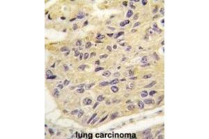 Immunohistochemistry (IHC) image for anti-Frequently Rearranged in Advanced T-Cell Lymphomas (FRAT1) antibody (ABIN2997937) (FRAT1 Antikörper)