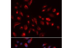 Immunofluorescence analysis of U2OS cells using CHRM5 Polyclonal Antibody (CHRM5 Antikörper)