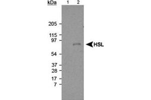 Western blot analysis of Lipe using Lipe polyclonal antibody . (LIPE Antikörper  (AA 699-908))