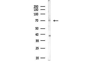 Western blot analysis of lysates from COLO205 cells, using KLHL24 Antibody at 1/1000 dilution.