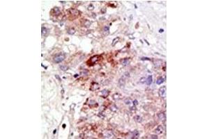 Image no. 2 for anti-Protein Inhibitor of Activated STAT, 1 (PIAS1) (N-Term) antibody (ABIN5552003) (PIAS1 Antikörper  (N-Term))