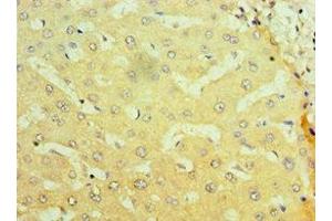 Immunohistochemistry (IHC) image for anti-Nuclear Receptor Subfamily 1, Group I, Member 2 (NR1I2) (AA 175-434) antibody (ABIN7161897)
