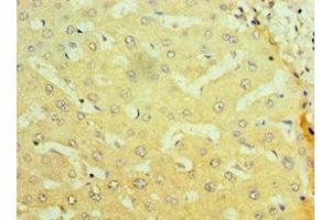Immunohistochemistry of paraffin-embedded human liver tissue using ABIN7161897 at dilution of 1:100 (NR1I2 Antikörper  (AA 175-434))