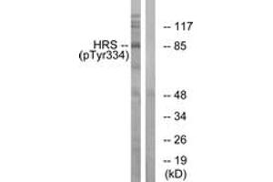 Western blot analysis of extracts from HepG2 cells treated with PMA 125ng/ml 30', using HRS (Phospho-Tyr334) Antibody. (HRS (HRS) (AA 301-350), (pTyr334) Antikörper)