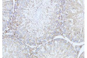 ABIN6279533 at 1/100 staining Mouse testis tissue by IHC-P. (MRAP Antikörper  (Internal Region))
