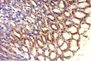 Immunohistochemistry (Paraffin-embedded Sections) (IHC (p)) image for anti-Heat Shock 60kDa Protein 1 (Chaperonin) (HSPD1) (AA 501-573) antibody (ABIN726080)