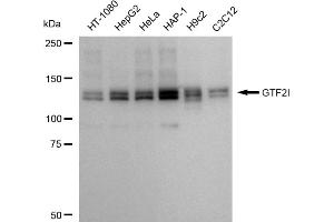Western blotting analysis using GTF2I antibody (ABIN7798709). (Rekombinanter GTF2I Antikörper)