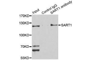 Immunoprecipitation analysis of 150 μg extracts of Jurkat cells using 3 μg SART1 antibody (ABIN5996293).