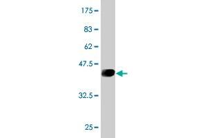 Western Blot detection against Immunogen (41. (UBE2D3 Antikörper  (AA 1-147))