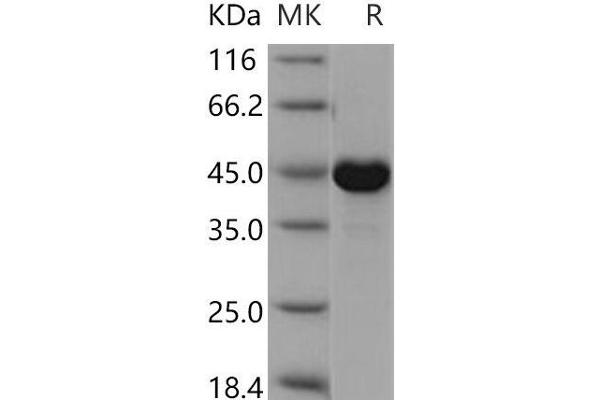 CKMT1A Protein (His tag)