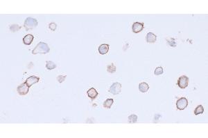 Immunocytochemistry (ICC) image for anti-Platelet Derived Growth Factor Receptor alpha (PDGFRA) (AA 24-525) antibody (ABIN7453341) (Rekombinanter PDGFRA Antikörper  (AA 24-525))