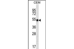 DAZ3 Antibody (C-term) (ABIN656239 and ABIN2845555) western blot analysis in CEM cell line lysates (35 μg/lane). (DAZ3 Antikörper  (C-Term))