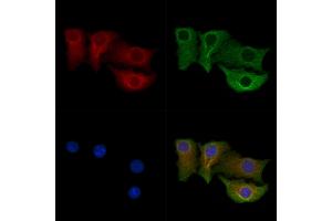 ABIN7094674 and ABIN7098725 staining Hela cells by IF/ICC. (CPEB4 Antikörper  (Internal Region))