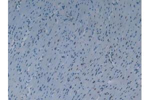 IHC-P analysis of Mouse Heart Tissue, with DAB staining. (KHDRBS1 Antikörper  (AA 156-381))
