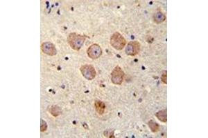 Immunohistochemistry (Paraffin-embedded Sections) (IHC (p)) image for anti-SKI Family Transcriptional Corepressor 2 (SKOR2) (AA 877-906), (C-Term) antibody (ABIN952407)
