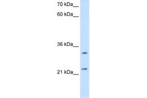 Western Blotting (WB) image for anti-Chromosome 21 Open Reading Frame 33 (C21orf33) antibody (ABIN2462904) (C21orf33 Antikörper)